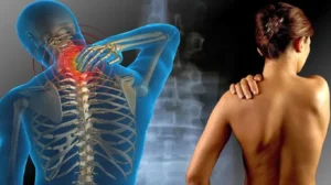 Que es fibromialgia